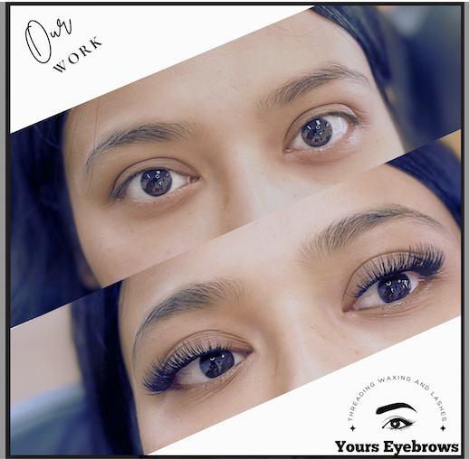 Natural Beauty Enhancement